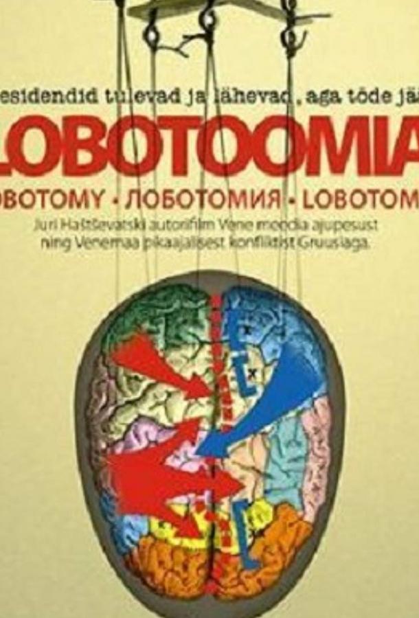 Лоботомия смотреть онлайн бесплатно в хорошем качестве